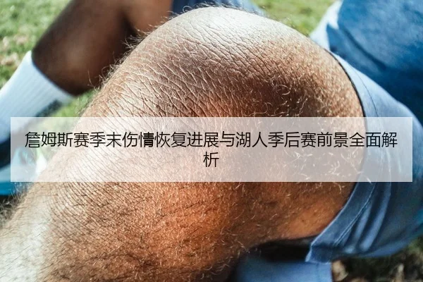 詹姆斯赛季末伤情恢复进展与湖人季后赛前景全面解析